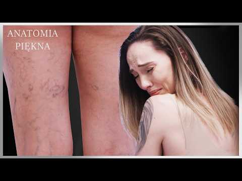 Podczas sek*u z mężem zakrywała swoje nogi ze wstydu | Anatomia piękna