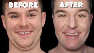 The Most Transformative Plastic Surgery for Men