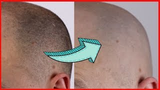 THE BEST HEAD SHAVER? -Head Shave With Foil Shaver - Remington F9