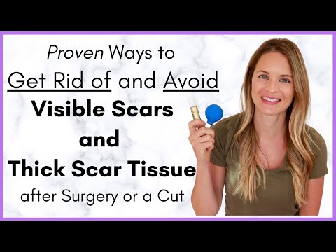 Proven Ways to Heal a Scar Quickly - Avoiding Scar Tissue after Surgery - By a Physical Therapist