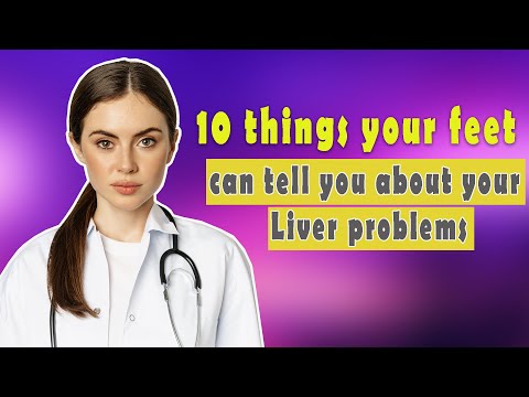 7 things your feet can tell you about your liver problems