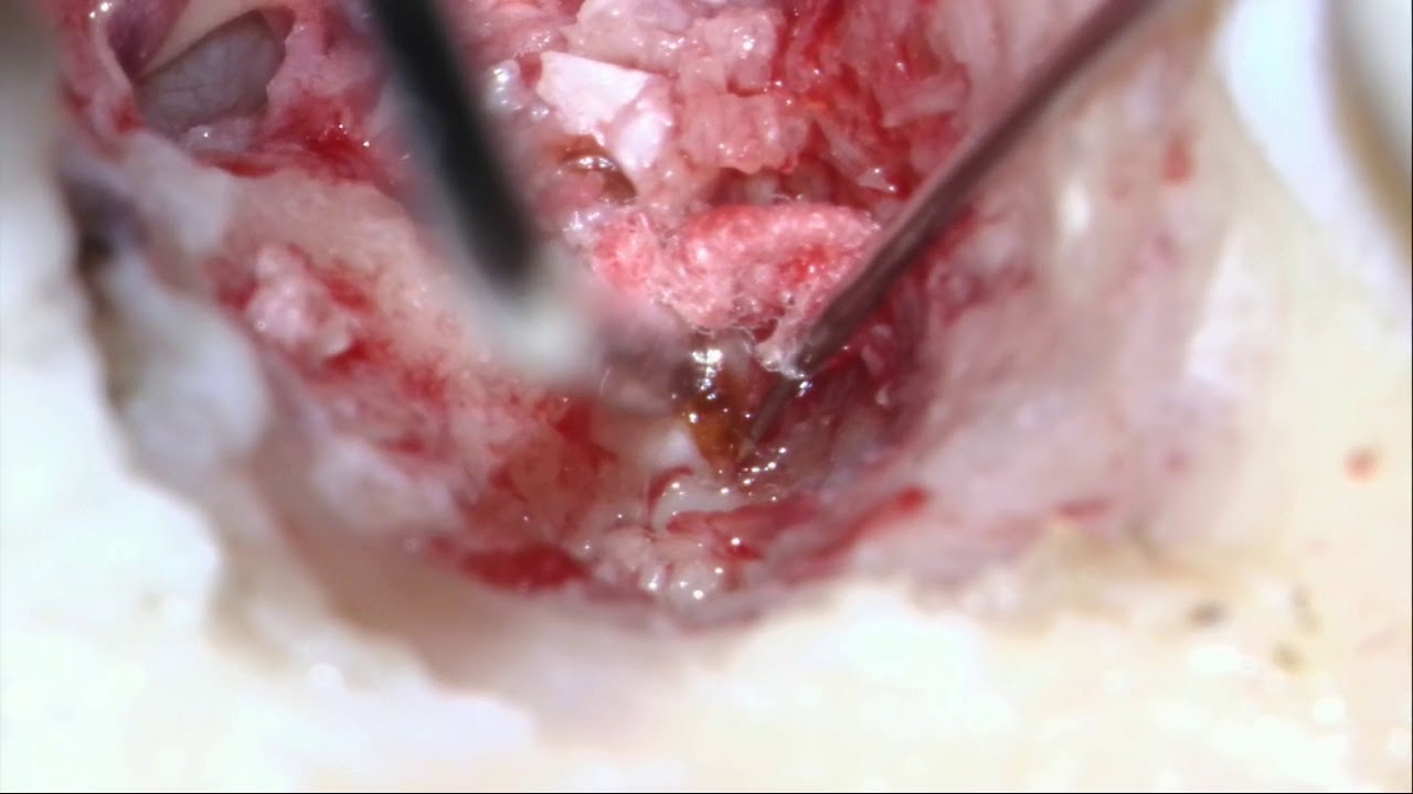 Placido Ostos Aumente-11