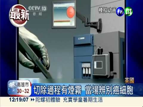 智慧手術刀! 3秒揪出癌細胞