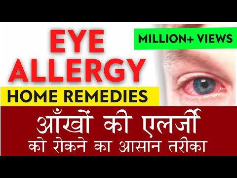 Home Remedies for Eye Allergy | Best treatment for Eye Allergy |आँखो की एलर्जी का सही और आसान इलाज |