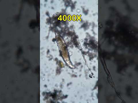 Dust In Our Nails In Microscope Under View #shorts #microscope #nails #germs #biology #micro