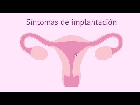Síntomas de implantación del embrión