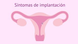 Síntomas de implantación del embrión