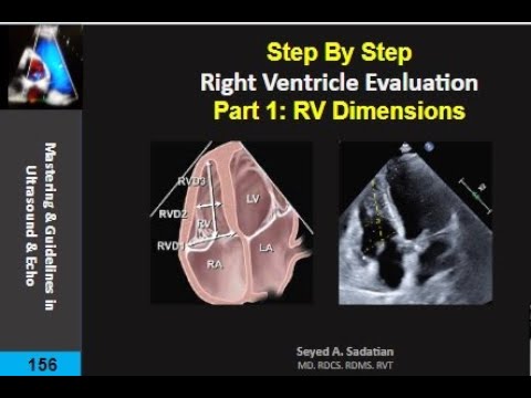 Step By Step: RV evaluation part 1:  measurements