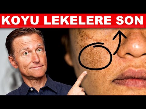 Hiperpigmentasyon İçin En İyi Çözüm | Dr. Berg Türkçe