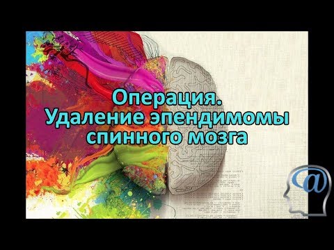 Остеохондроз ватные ноги Слабость тошнота боль в животе и пояснице