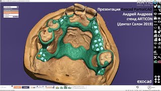 Презентация Exocad PartialCAD от Андрея Андреева на стенде ARTICON (Дентал Салон 2019)