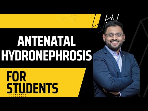 Antenatal Hydronephrosis क्या है? | Causes, Symptoms & Treatment in Newborns | Dr. Kunal Pai