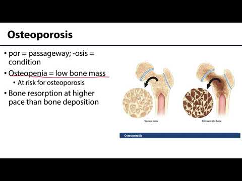 MSK Skeletal System Basics - Aging and Osteoporosis