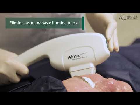 Eliminar Manchas Luz Pulsada IPL