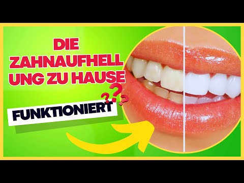 Die 5 Besten Produkte zur Zahnaufhellung zu Hause | WIE MAN ZÄHNE ZU HAUSE AUFHELLT