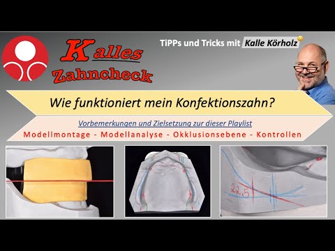 Kalles Zahncheck - Wie funktioniert mein Konfektionszahn perfekt? Hier: Modellanalyse und Kontrollen