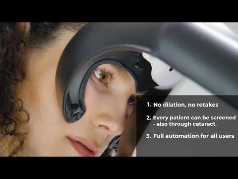 Icare Illume Workflow