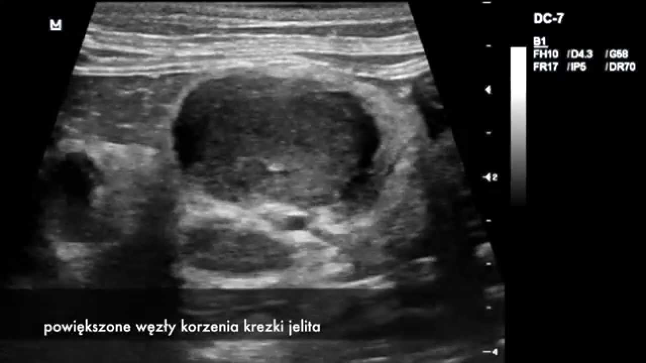 Barbara Górnicka-15