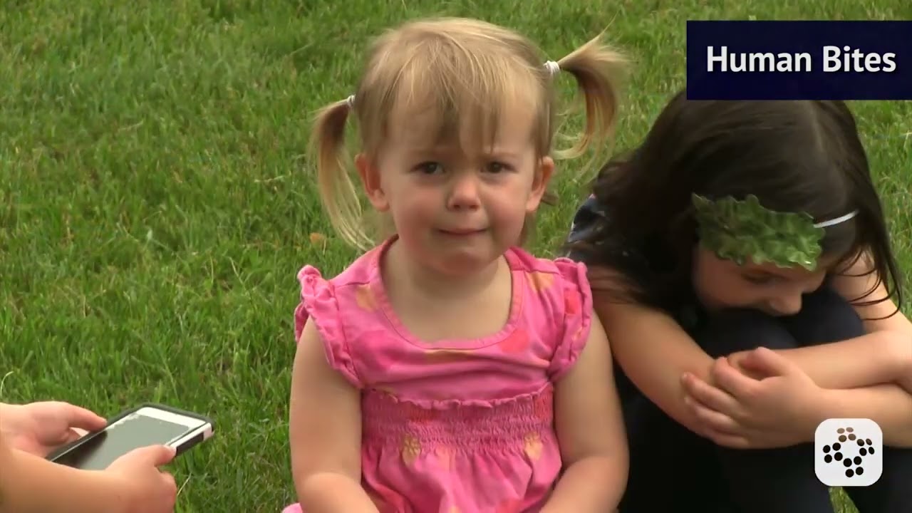 Animal and Human Bites