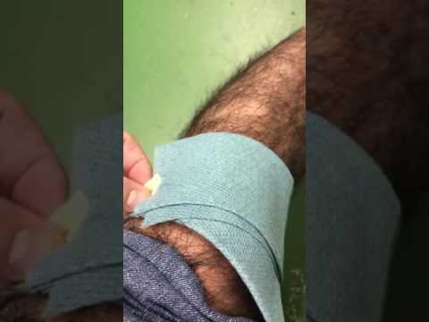 Dolore alla schiena dà il diritto di fare Mal di schiena nella zona dei reni