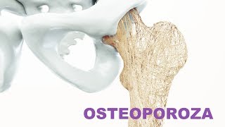 Osteoporoza poate fi descoperita in doar 5 minute! Afla aici cum!