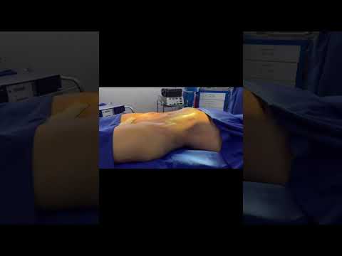 Transforma tu vida con la cirugía plástica en Cartagena o Bogotá del Dr. Carlos Zuleta Bechara