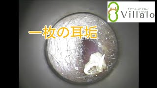 耳掃除動画vol.52「一枚の耳垢」