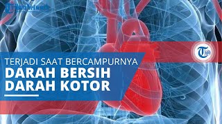 Eisenmenger, Sindrom yang Terjadi saat Darah Bersih Bercampur dengan Darah Kotor