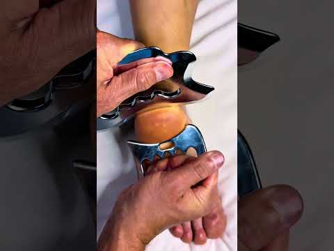 Do NOT Ignore This on Your Heel — It’s a Major Internal Red Flag”  #asmr #footmassage #asmrmassage