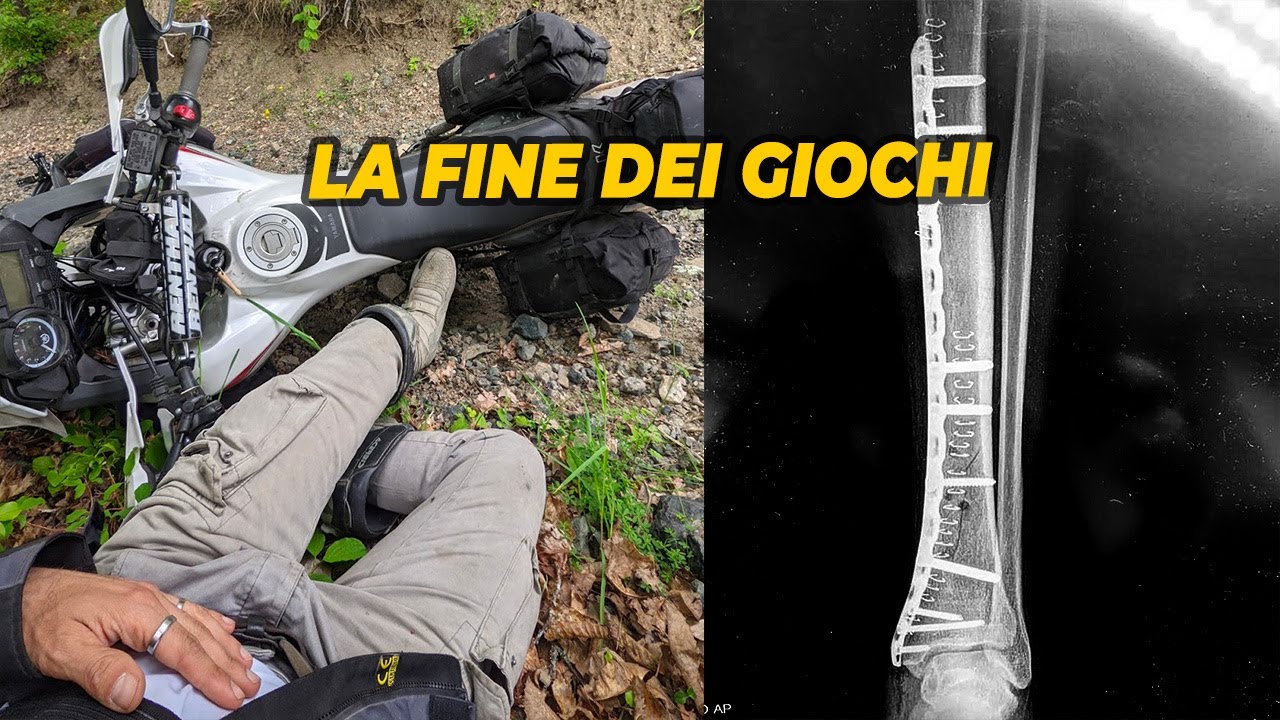 Watch Now LA FINE DEI GIOCHI RACCONTO DELL'INCIDENTE E OPERAZIONE LA FINE DEI GIOCHI RACCONTO DELL'INCIDENTE E OPERAZIONE