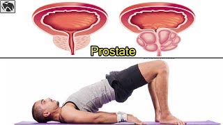 7 Prostate INFECTION Natural Home Remedies | Prostate Infection