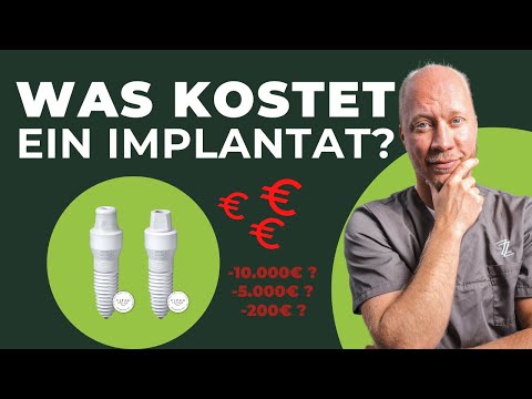 Wie teuer ist ein Zahnimplantat: Infos über Kosten