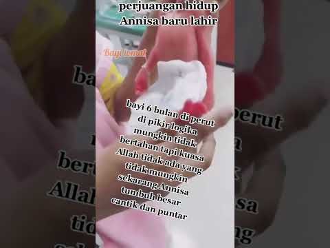 , title : 'Masya Allah Perjuangan Annisa Bayi Lahir usia 6 bln 🥲semoga kelak menjadi anak Cerdas & sukses 🤲amin'