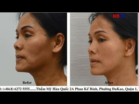 download lagu mp3 mp4 Cang Da Mat Bao Nhieu Tien, download lagu Cang Da Mat Bao Nhieu Tien gratis, unduh video klip Cang Da Mat Bao Nhieu Tien