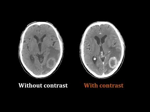 How is a routine CT scan of the head performed? Procedures in computed tomography imaging