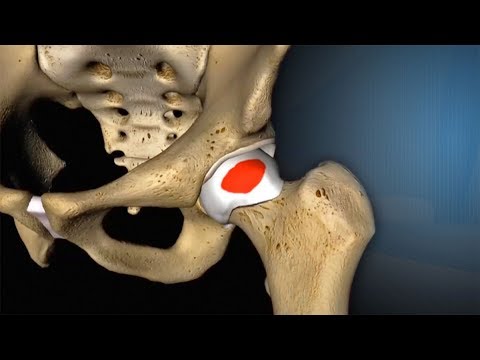Im Zusammenhang mit Osteochondrose Krankheit Füße Fußgelenke Volksmedizin