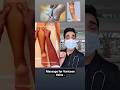 Massage For Varicose Vein