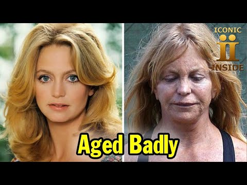 25 Celebrities Who Have Aged Badly