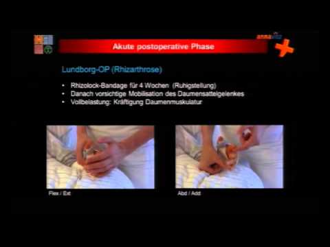 Diclofenac und Osteochondrose Reduziert Beinkrämpfe in Osteochondrose