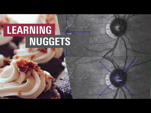 🇩🇪 Glaukom – Erstuntersuchung durchführen | SPECTRALIS GMPE