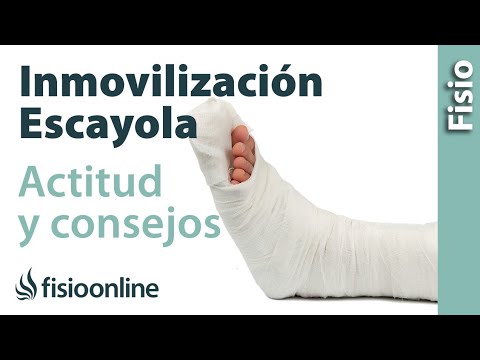 What to do while you have a cast on