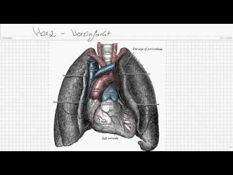 Bildung von Blutdruck Röntgenstrahlen hypertensive Krankheit