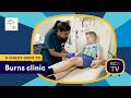 A Child S Guide To Hospital Burns Clinic