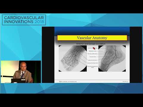 CVI2018 Session: Pedal arch reconstruction, why and how