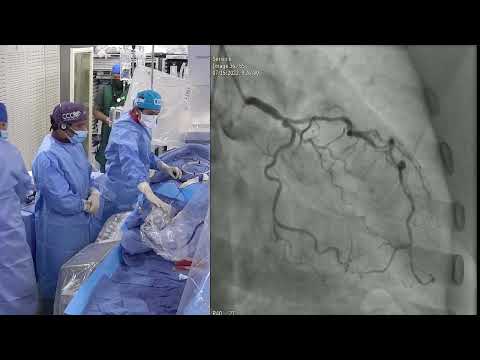 Live Relay: Sun Pharma - July 2022