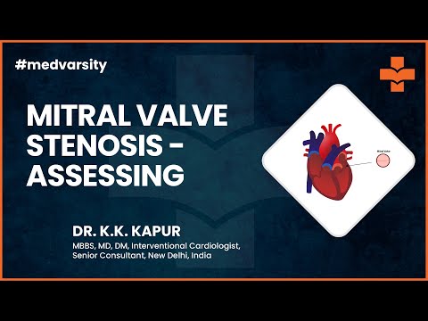Case Discussion: Mitral Valve Stenosis - Assessing & Criteria | @MedvarsityTechnologiesPvtLtd