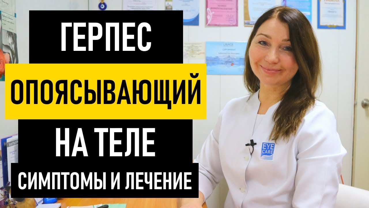 Опоясывающий Герпес (Лишай): симптомы и лечение у взрослых. Чем и как лечить герпес на теле