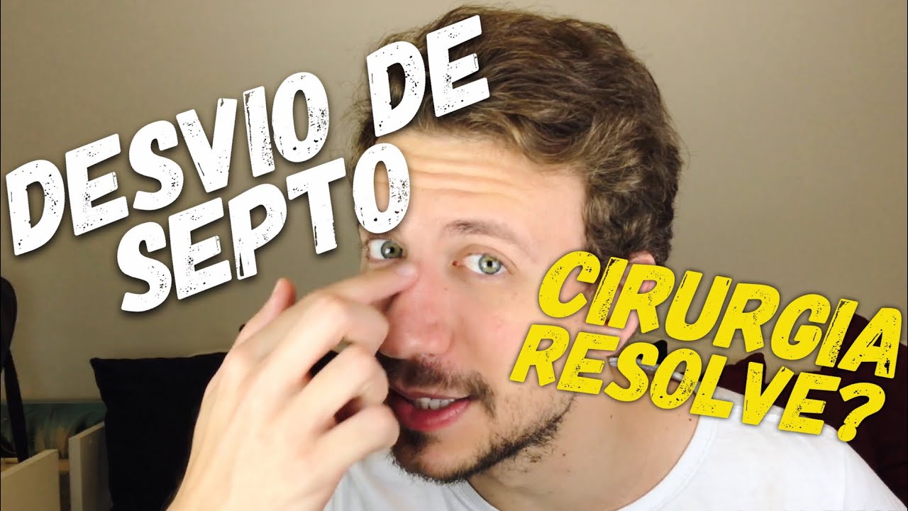 OPEREI MEU NARIZ - ANTES E DEPOIS DA CIRURGIA DE DESVIO DE SEPTO E PÓS OPERATÓRIO