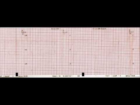 Sołtys - Serce wariata