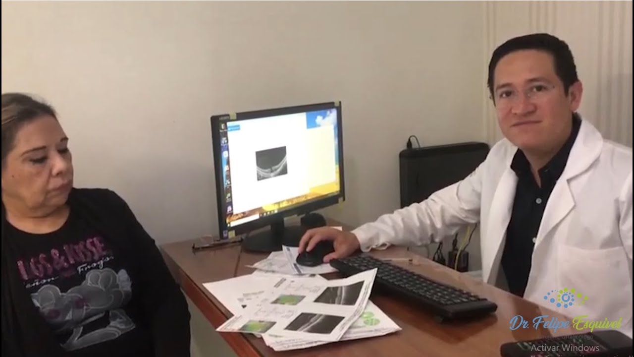 DESPRENDIMIENTO DE VITREO POSTERIOR